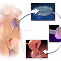 What is the IVF Success Rate?