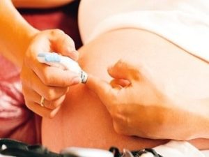 Is It Possible To Have Natural Delivery With Gestational Diabetes