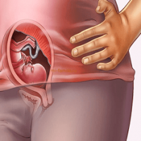 Uterus Size During Pregnancy