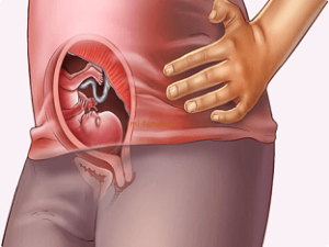 Uterus Size During Pregnancy