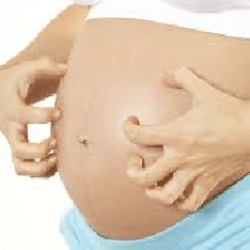 Home remedies to treat itchy bellies during pregnancy