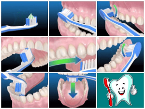 Тщательно и правильно чистить зубы. Как сделать зубы чистыми
