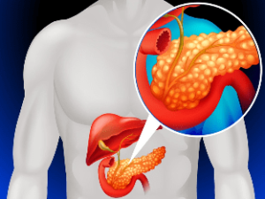 Что такое панкреатит? Симптомы и последствия