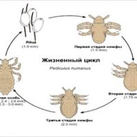 Как избавиться от вшей?