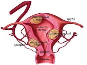 Миома матки и беременность