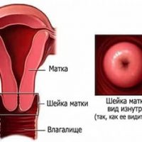 Шейка матки во время беременности